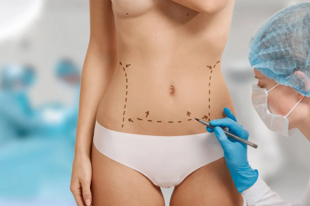 Lipoescultura avanzada y contorno corporal